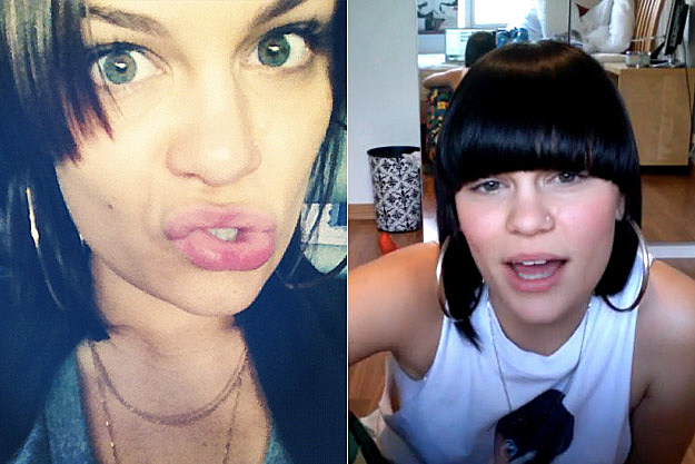 Jessie J Jessie J