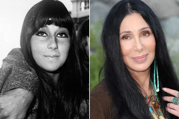 Cher Plastic Surgery Pictures Cher Plastic Surgery Pictures