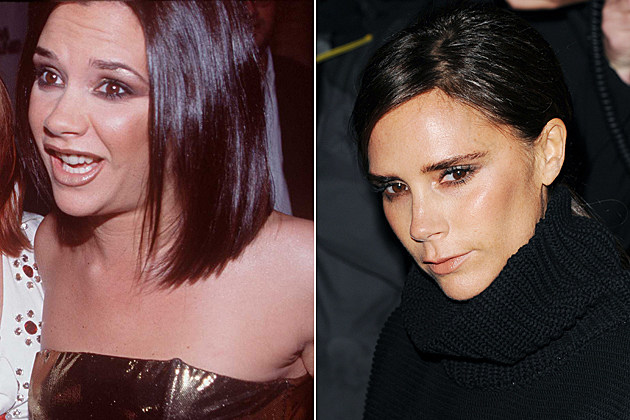 Famous Nose Jobs - Before And After [PHOTOS]