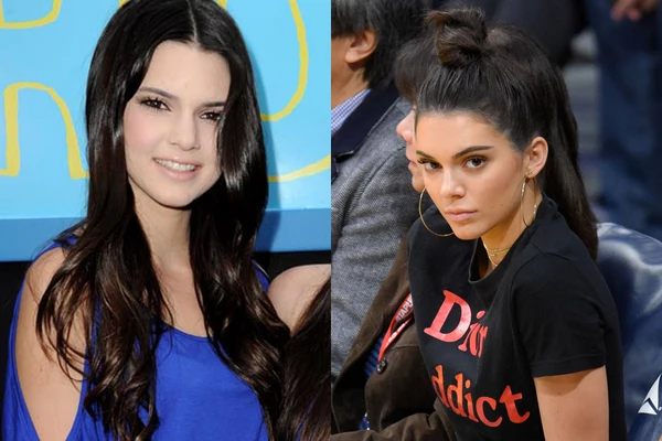 Did Kendall Jenner Get Plastic Surgery? Model Calls Accusations 'Crazy'