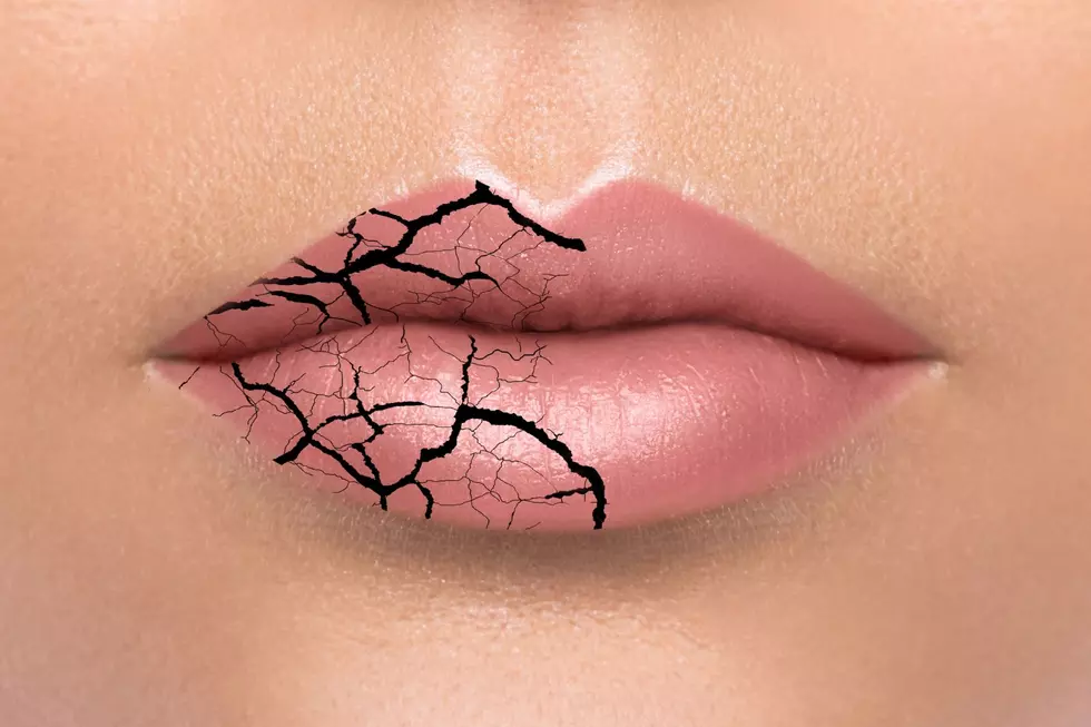Chapped Lips Suck, so What Kind of Lip Balms Really Work?
